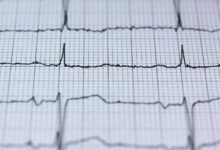 drive branding pulse horizon