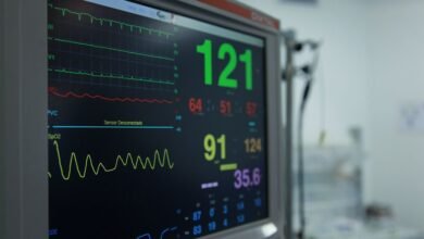 monitor registry lookups ids listed
